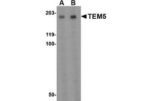 Western blot analysis of TEM5 in rat kidney tissue lysate with this product at (A) 2 µg/ml and (B) 4 μg/ml. (GPR124 抗体  (Center))