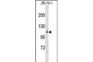RCH10 Antibody (Center) (ABIN1538179 and ABIN2849108) western blot analysis in ZR-75-1 cell line lysates (35 μg/lane). (MARCH10 抗体  (AA 248-274))