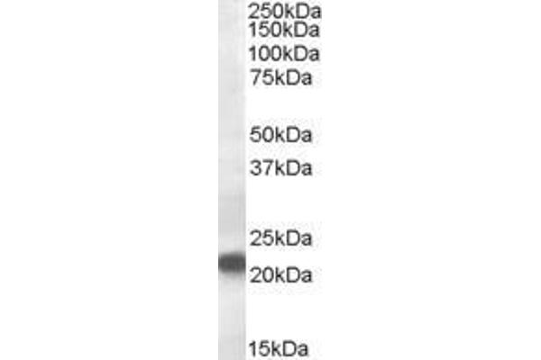 VPS25 抗体  (Internal Region)