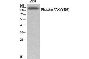 Western Blot (WB) analysis of specific cells using Phospho-FAK (Y407) Polyclonal Antibody. (FAK 抗体  (pTyr407))