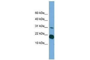 Western Blot showing IL1F5 antibody used at a concentration of 1-2 ug/ml to detect its target protein. (FIL1d 抗体  (Middle Region))