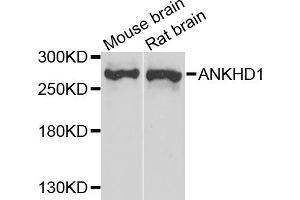Western blot analysis of extracts of various cell lines, using ANKHD1 antibody (ABIN5974808) at 1/1000 dilution. (ANKHD1 抗体)