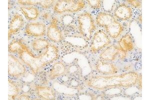 ABIN6262232 and ABIN6266695 at 1/100 staining human normal kidney tissue by IHC-P. (HGS 抗体  (Internal Region))