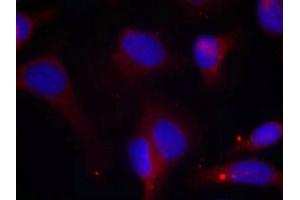 Immunofluorescence staining of methanol-fixed Hela cells using Zap-70(Phospho-Tyr319) Antibody. (ZAP7 (pTyr319) 抗体)