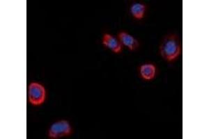 Immunofluorescent analysis of GPR101 staining in HeLa cells. (GPR101 抗体  (C-Term))