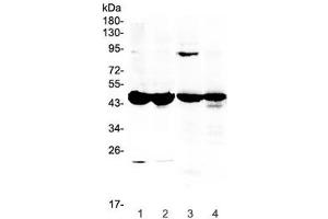 Western blot testing of 1) mouse testis, 2) mouse ovary, 3) rat stomach and 4) rat ovary lysate with Ada antibody at 0. (ADA 抗体  (AA 2-241))