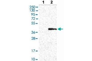 Western blot analysis of Lane 1: Negative control (vector only transfected HEK293T lysate), Lane 2: Over-expression lysate (Co-expressed with a C-terminal myc-DDK tag (~3. (CTSO 抗体  (AA 71-176))