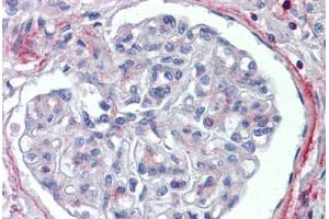 Human Kidney (formalin-fixed, paraffin-embedded) stained with PODXL antibody ABIN462244 followed by biotinylated goat anti-rabbit IgG secondary antibody ABIN481713, alkaline phosphatase-streptavidin and chromogen. (PODXL 抗体  (AA 301-350))
