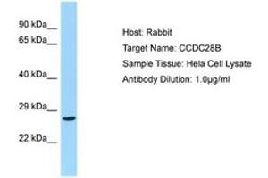 Image no. 1 for anti-Coiled-Coil Domain Containing 28B (CCDC28B) (C-Term) antibody (ABIN6750165) (CCDC28B 抗体  (C-Term))