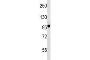 Integrin beta 7 antibody western blot analysis in WiDr lysate. (Integrin beta 7 抗体  (AA 737-765))