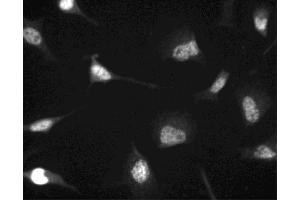 Immunofluorescent staining of HeLa (ATCC CCL-2) cells. (CDK4 抗体  (N-Term))