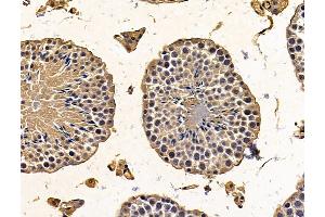 ABIN7096215 and ABIN7100277 at 1/100 staining mouse testis tissue by IHC-P. (PTCD1 抗体)