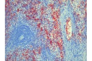 anti-Platelets antibody