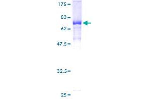 JMJD5 Protein (AA 1-416) (GST tag)