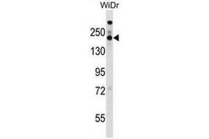 STAG1 Antibody (Center) western blot analysis in WiDr cell line lysates (35µg/lane). (Stromal Antigen 1 抗体  (Middle Region))