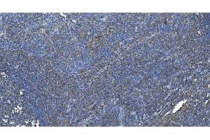 IHC analysis of DGKZ/DGK-zeta using anti-DGKZ/DGK-zeta antibody (ABIN7602261).