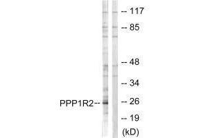 Western blot analysis of extracts from Jurkat cells, using PPP1R2 (Ab-120/121) antibody. (PPP1R2 抗体  (Ser120, Ser121))