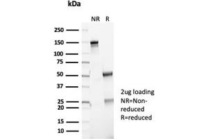 SDS-PAGE Analysis Purified P16INK4a Recombinant Rabbit Monoclonal (CDKN2A/7081R). (Recombinant CDKN2A 抗体)