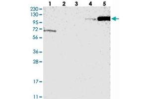 Western blot analysis of Lane 1: RT-4, Lane 2: U-251 MG, Lane 3: Human Plasma, Lane 4: Liver, Lane 5: Tonsil with ANKRD44 polyclonal antibody . (ANKRD44 抗体)