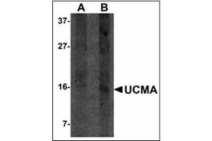 Western blot analysis of UCMA in SW1353 cell lysate with UCMA antibody at (A) 2. (UCMA 抗体  (C-Term))