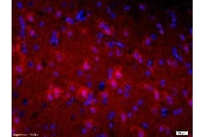 Formalin-fixed and paraffin-embedded rat brain labeled with Mouse Anti-Alpha-Synuclein Polyclonal Antibody, Unconjugatedused at 1:200 dilution for 40 minutes at 37°C. (Alpha, beta Synuclein (AA 122-140) 抗体)