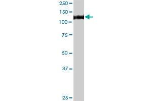 GAA MaxPab rabbit polyclonal antibody. (GAA 抗体  (AA 1-952))