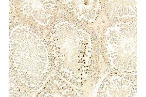 ABIN6254919 and ABIN6267567 at 1/100 staining Rat testis tissue by IHC-P.