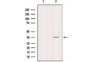 Western blot analysis of extracts from Mouse spleen, using FN3K Antibody.