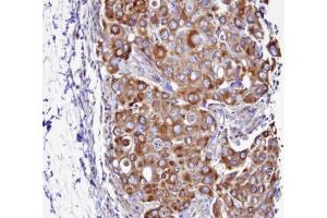 IHC-P Image Immunohistochemical analysis of paraffin-embedded H441 xenograft, using SEPT2 , antibody at 1:100 dilution. (Septin 2 抗体)