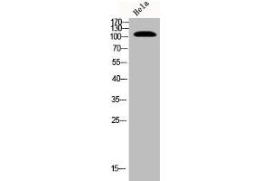 Western Blot analysis of Hela cells using Phospho-EphB1/2 (Y594/604) Polyclonal Antibody (EPH Receptor B1 抗体  (pTyr594, pTyr604))