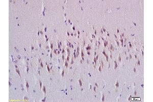 Formalin-fixed and paraffin embedded rat brain tissue labeled with Anti-Rab24 Polyclonal Antibody, Unconjugated (ABIN750373) at 1:200 followed by conjugation to the secondary antibody and DAB staining (RAB24 抗体  (AA 1-100))