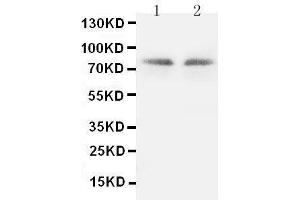 Anti-PKC gamma antibody, Western blotting Lane 1: Rat Brain Tissue Lysate Lane 2: Rat Brain Tissue Lysate (PKC gamma 抗体  (C-Term))