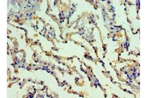 Immunohistochemistry of paraffin-embedded human lung tissue using ABIN7155522 at dilution of 1:100 (SMYD1 抗体  (AA 1-350))