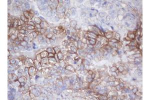 Image no. 1 for anti-Melanoma Antigen Family B, 18 (MAGEB18) antibody (ABIN1499274) (MAGEB18 抗体)
