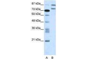 Human Jurkat; WB Suggested Anti-ZNF709 Antibody Titration: 2. (ZNF709 抗体  (N-Term))