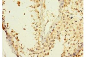 Immunohistochemistry of paraffin-embedded human testis tissue using ABIN7150058 at dilution of 1:100