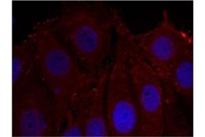 Image no. 1 for anti-Synuclein, alpha (SNCA) (pTyr133) antibody (ABIN401574) (SNCA 抗体  (pTyr133))