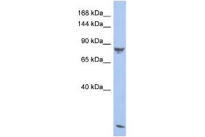 Western Blotting (WB) image for anti-phosphodiesterase 6A, CGMP-Specific, Rod, alpha (PDE6A) (N-Term) antibody (ABIN2786520) (PDE6A 抗体  (N-Term))
