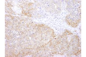 Immunohistochemistry (IHC) image for anti-Eukaryotic Elongation Factor-2 Kinase (EEF2K) (AA 675-725) antibody (ABIN7448957)