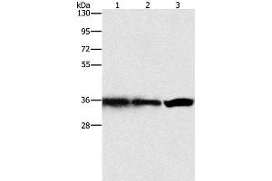 Western Blot analysis of Hela, 293T and 231 cell using GNB1 Polyclonal Antibody at dilution of 1:450 (GNB1 抗体)