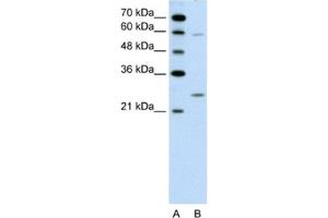 Western Blotting (WB) image for anti-Guanidinoacetate N-Methyltransferase (GAMT) antibody (ABIN2462453) (GAMT 抗体)