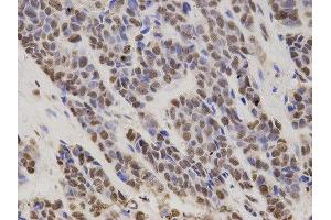 Immunohistochemistry (IHC) image for anti-Hepatoma-Derived Growth Factor (HDGF) antibody (ABIN1876535) (HDGF 抗体)