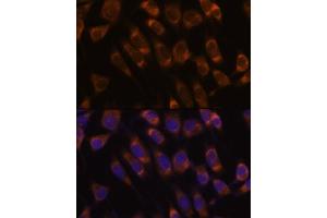 Immunofluorescence analysis of L929 cells using SEC61B antibody (ABIN7270173) at dilution of 1:100. (SEC61B 抗体  (AA 1-96))