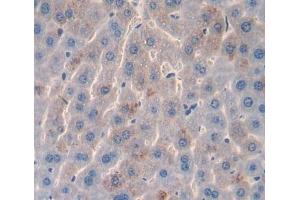 Used in DAB staining on fromalin fixed paraffin- embedded liver tissue (AADAT 抗体  (AA 99-425))