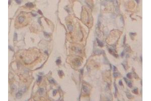 Detection of ACTG in Human Stomach Tissue using Polyclonal Antibody to Gamma Actin (ACTG) (Actin, gamma 1 抗体  (AA 1-375))