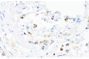 Immunohistochemistry of paraffin-embedded Human lung using CAMP Polyclonal Antibody at dilution of 1:200 (40x lens). (Cathelicidin 抗体)