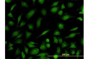 Image no. 3 for anti-RAB21, Member RAS Oncogene Family (RAB21) (AA 116-226) antibody (ABIN599189) (RAB21 抗体  (AA 116-226))