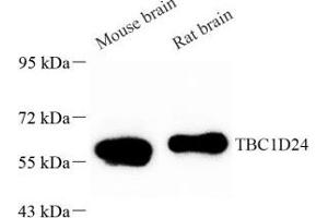 Western blot analysis of TBC1D24 (ABIN7075847) at dilution of 1: 1000 (TBC1D24 抗体)
