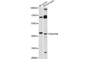 Western blot analysis of extracts of various cell lines, using ZSCAN4 antibody. (ZSCAN4 抗体)