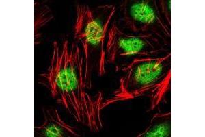 Immunofluorescence analysis of Hela cells using ZBTB16 antibody (green). (ZBTB16 抗体)